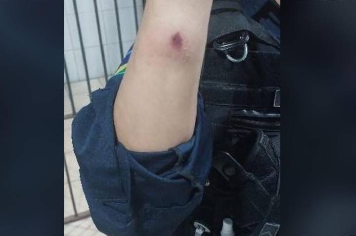 Policial Militar é atacado a mordidas durante registro de ocorrência na zona leste de Porto Velho