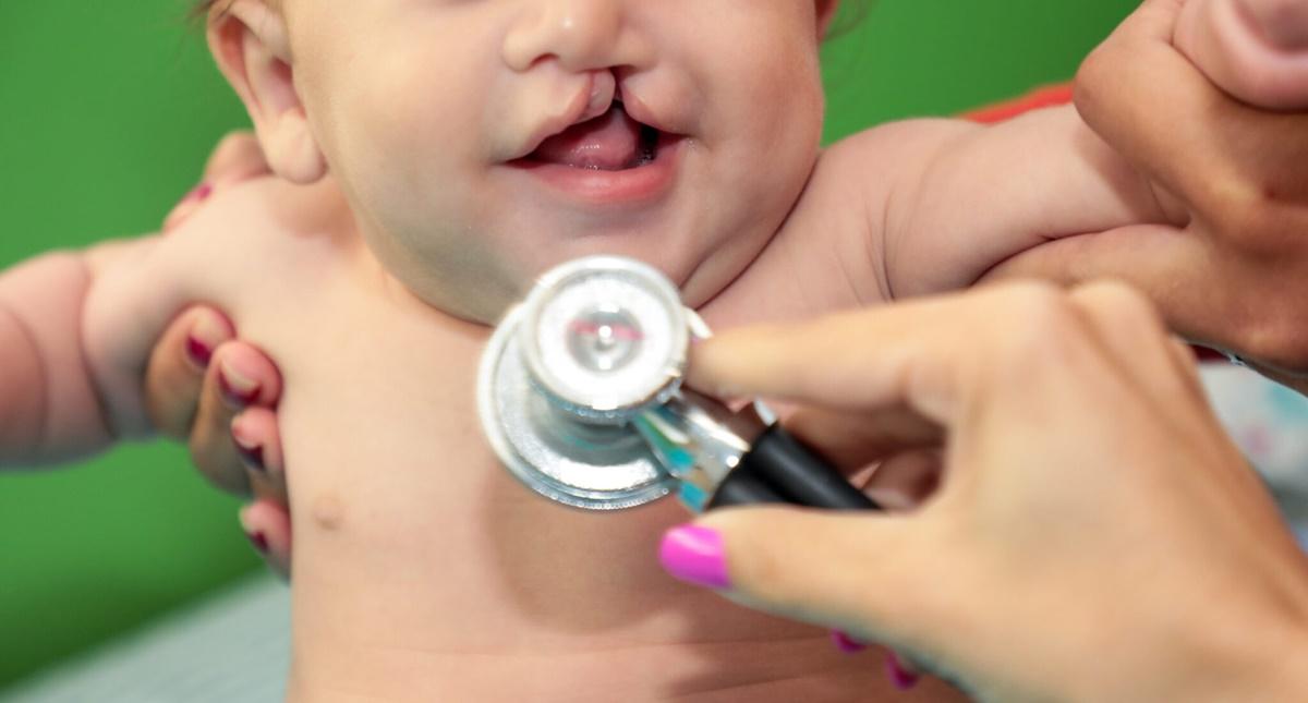 Atendimento especializado: Governo de RO marca consultas para pacientes com fissuras labiopalatinas via WhatsApp