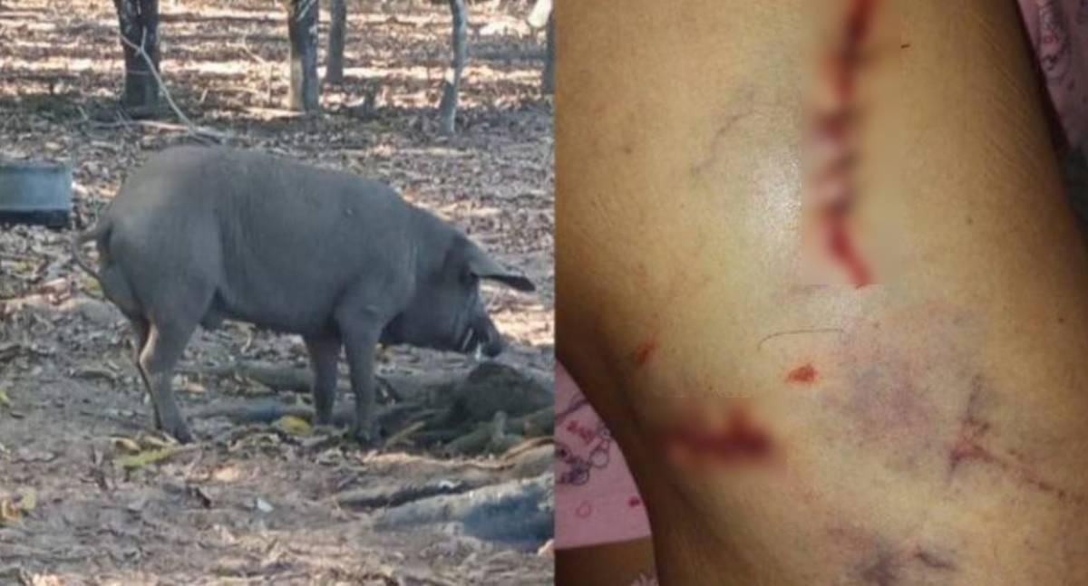 Idosa sofre ataque grave de porco doméstico dentro de chiqueiro