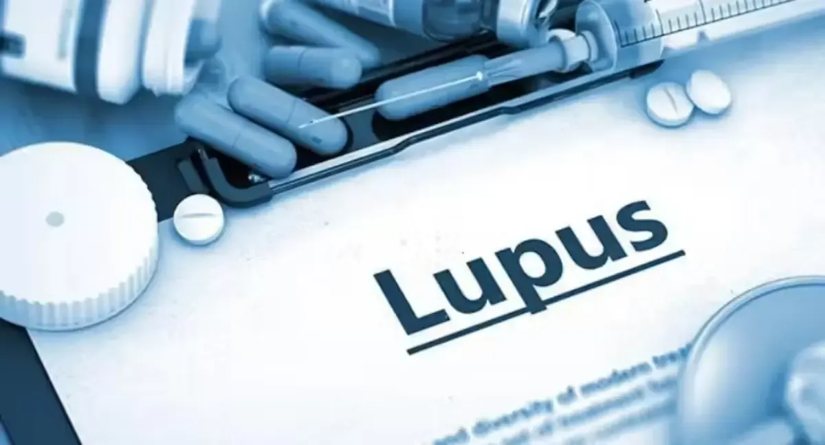 Tratamento para lúpus será obrigatório nos planos de saúde a partir de novembro, define ANS