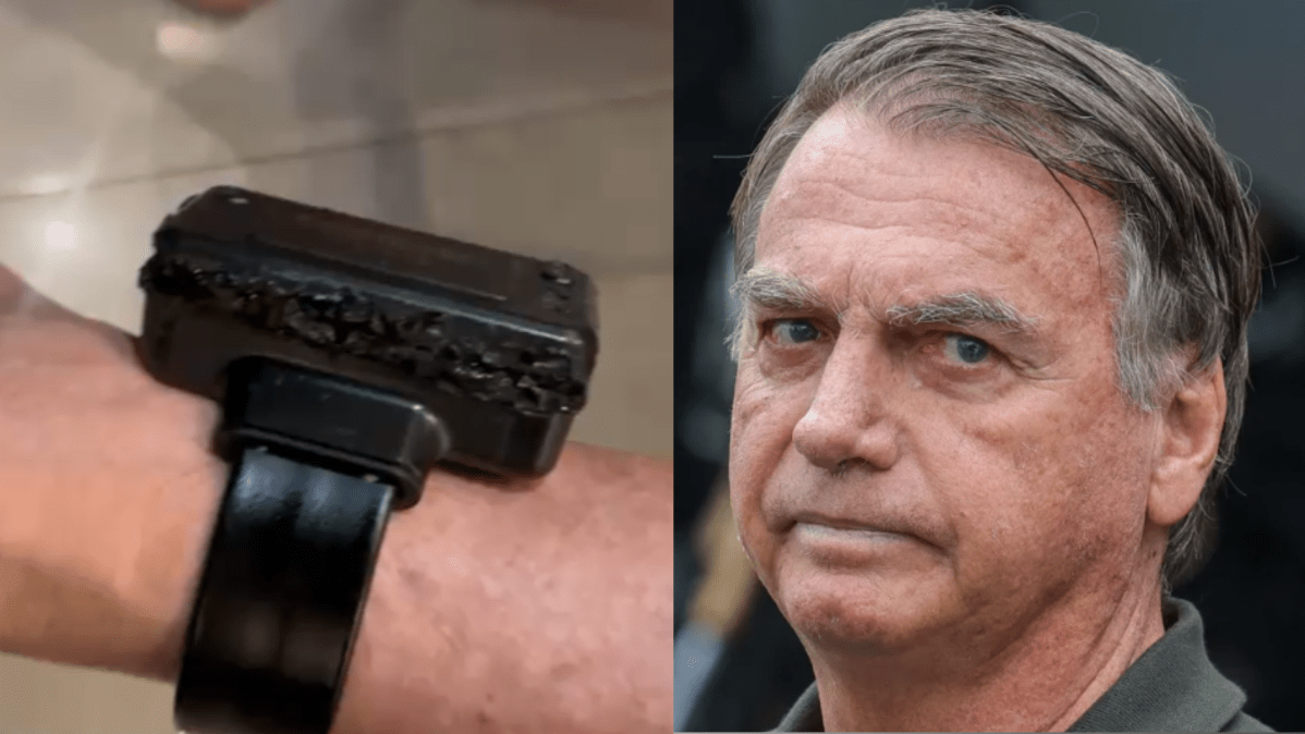 Defesa de Bolsonaro relata ao STF violação em tornozeleira: confusão mental