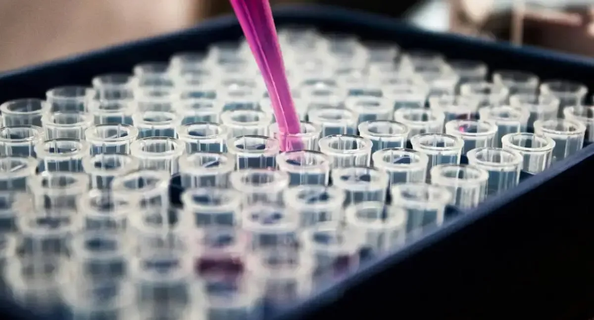 Estudo sugere que inflamação é chave para o estabelecimento e progressão do Alzheimer