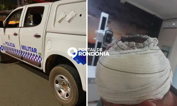 Homem é baleado na cabeça após suspeito sacar arma e dizer “aqui é CV”